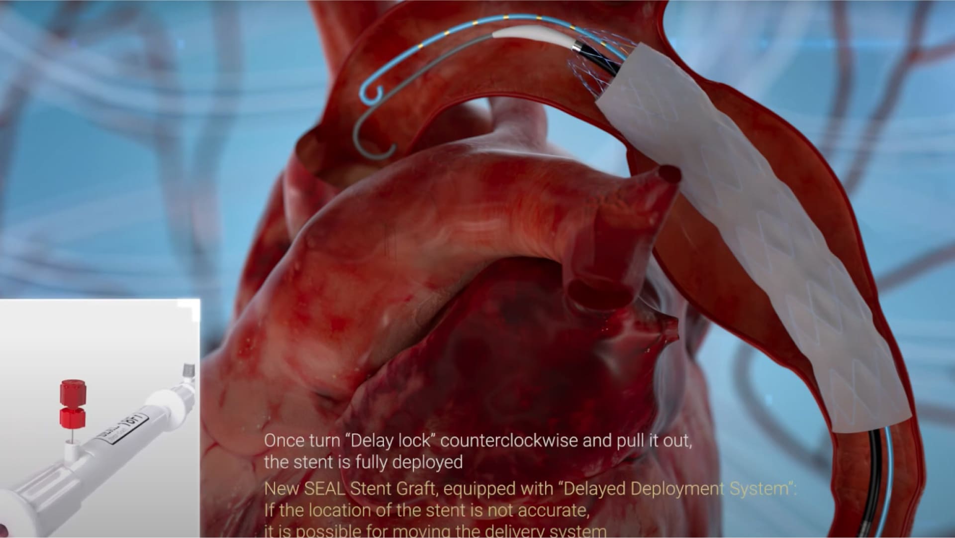 에스앤지바이오텍